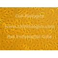 ZDF Rat Diabetic Aortic Endothelial Cells